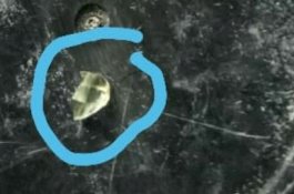 Diduga Malapraktik, Ditemukan Serpihan Kaca di Luka Pasien Usai Dirawat di Puskesmas Jeneponto