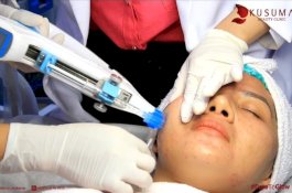 Promo Akhir Tahun dari Kusuma Beauty Clinic Makassar, Dapatkan Diskon hingga 50 persen