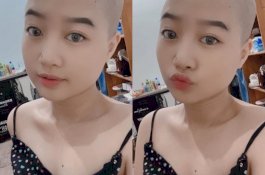 Dukung Ayah yang Mengidap Kanker, Wanita Cantik Ini Rela Botak