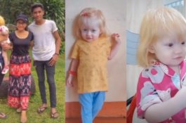 Bukan Albino, Bocah di NTT Ini Beda dari Saudaranya yang Lain