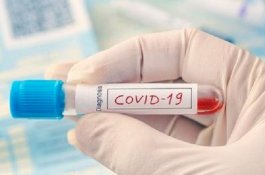 Tes Covid-19 dengan Air Liur, Lebih Murah dan Cepat