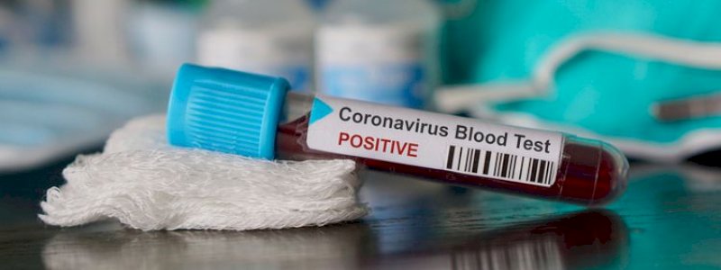 Melandai, Kasus Positif Covid-19 di Sulsel Hanya Bertambah 66 dalam 24 Jam