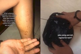 Cerita Mistis Istri, Kaki Suaminya Tiba-tiba Mengeluarkan Darah