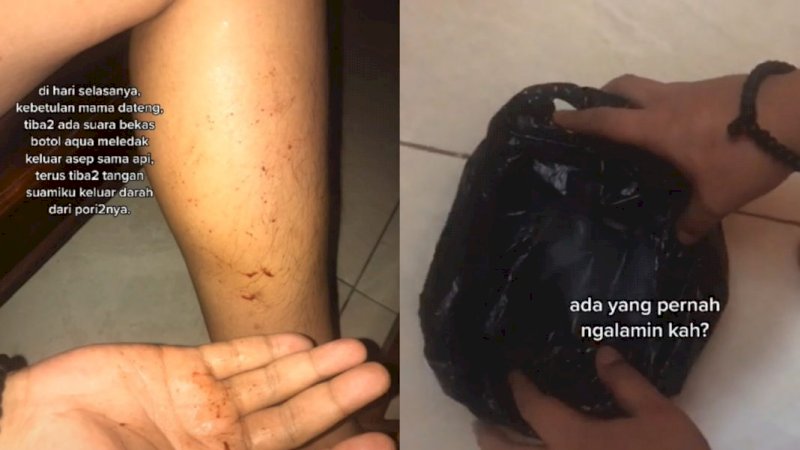 Viral cerita mistis wanita yang tangan suaminya mengeluarkan darah, dikepret daun kelor (TikTok/anabulnyamame)