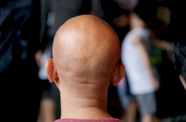 Jatuh Cinta pada Pria Beda Agama, Gadis Ini Digunduli Keluarga