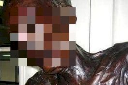 Memakan Daging 7 Anak, Mayat Manusia Kanibal Ini Dipamerkan Selama 62 Tahun