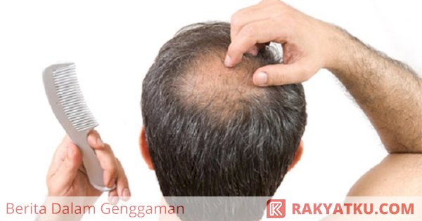 Orang Botak Memiliki Nafsu Seks Tinggi Mitos Atau Fakta