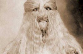 Cerita Pria Berwajah Singa di Abad-20