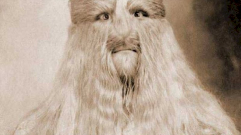 Stephan Bibrowksi dijuluki sebagai 'The Lion Face Man'. (scienceinfo.net)